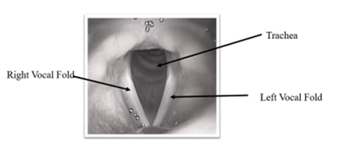 Open Vocal Folds During Breathing (Abducted)