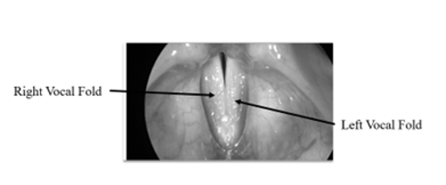 Vocal Folds During Phonation (Adducted)